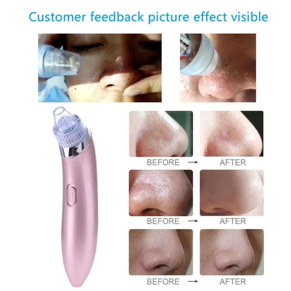 Electric Blackhead Remover Acne Pro Vacuum Pore Cleaner CW-666